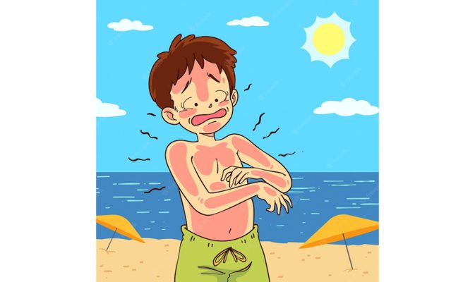 تحریک-پوستی-ناشی-از-گرما